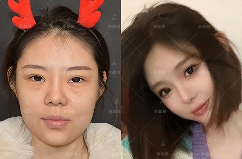 《狂飙》李一桐和白鹿谁更美?这是皮相和骨相美之争!