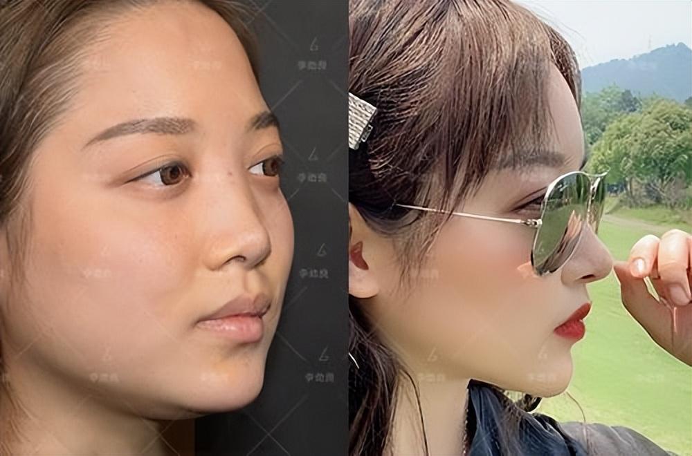《狂飙》李一桐和白鹿谁更美?这是皮相和骨相美之争!