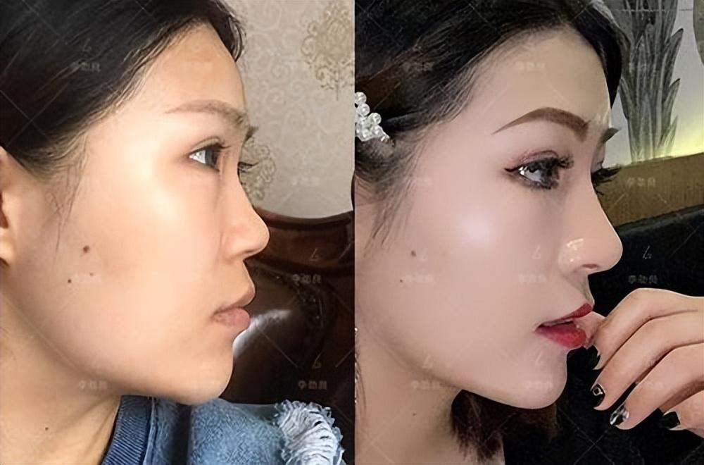 《狂飙》李一桐和白鹿谁更美?这是皮相和骨相美之争!