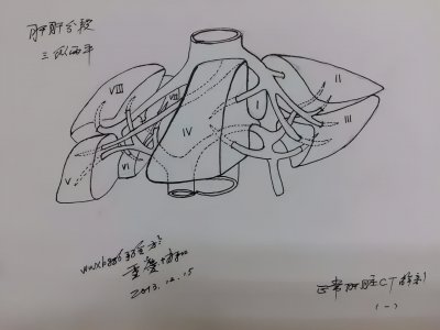 ​37张手绘图，看肝脏CT片原来如此简单