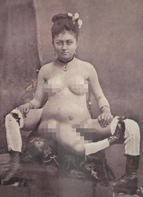 图揭19世纪“怪胎” 身体畸形诡异神秘