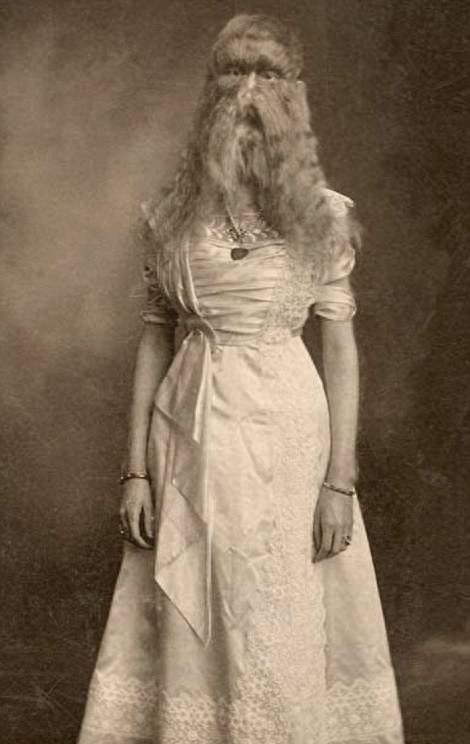 图揭19世纪“怪胎” 身体畸形诡异神秘