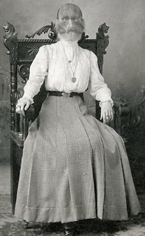 图揭19世纪“怪胎” 身体畸形诡异神秘