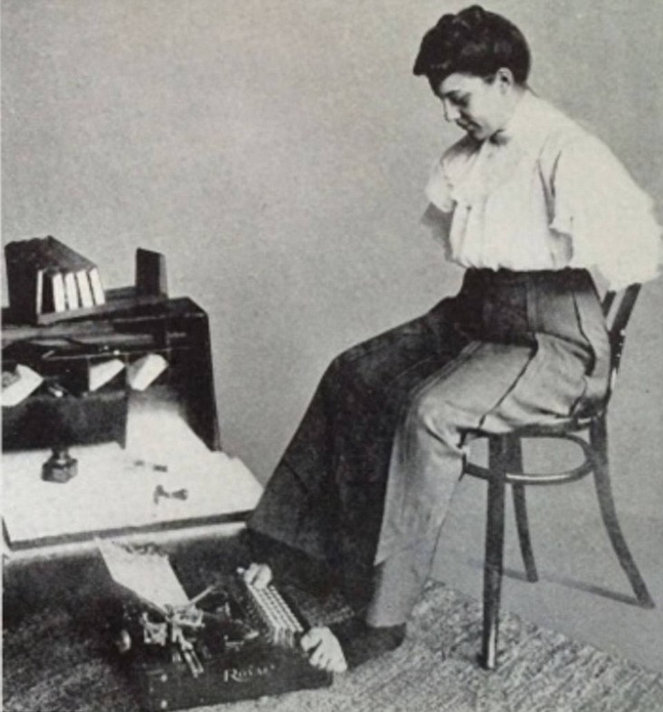 图揭19世纪“怪胎” 身体畸形诡异神秘