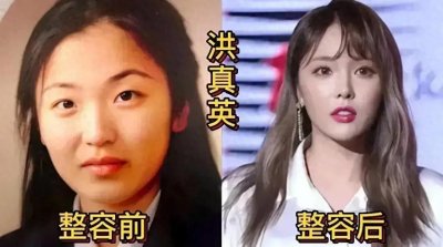 ​整容的韩国女星，有的从丑到绝世美女，看完你还相信“美女”吗？