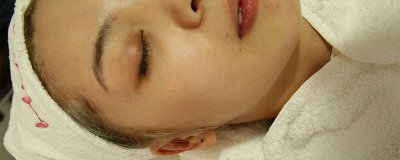 ​嘴唇脱皮是缺维生素几