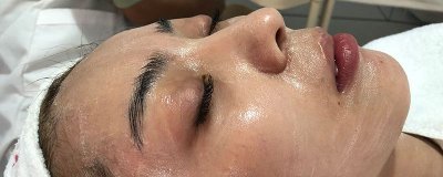 ​鱼尾纹是什么